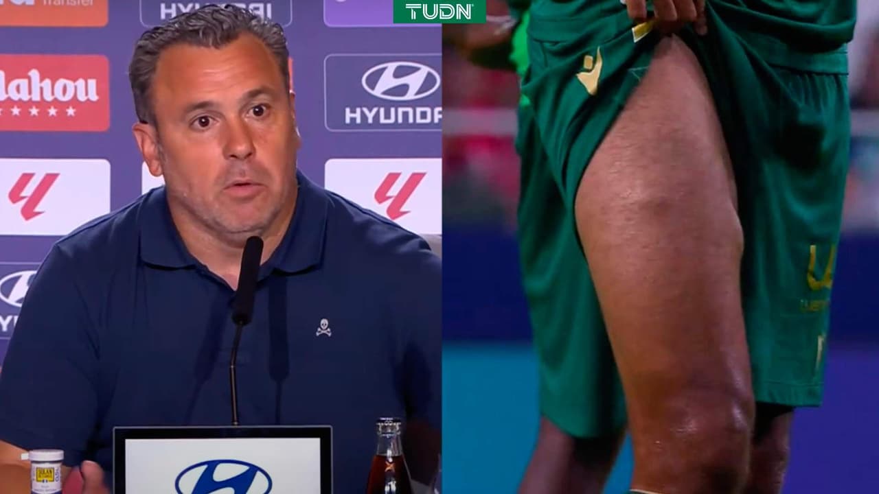 Entrenador del Cádiz revela motivo de los bultos en la pierna de Fali