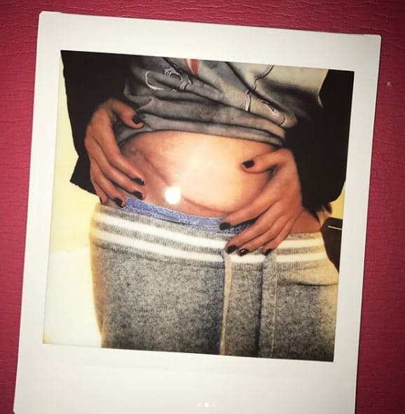 Como se sabe, Selena sufre de una enfermedad llamada lupus, la cual puede afectar tanto al riñón como al corazón y a las células de la sangre.