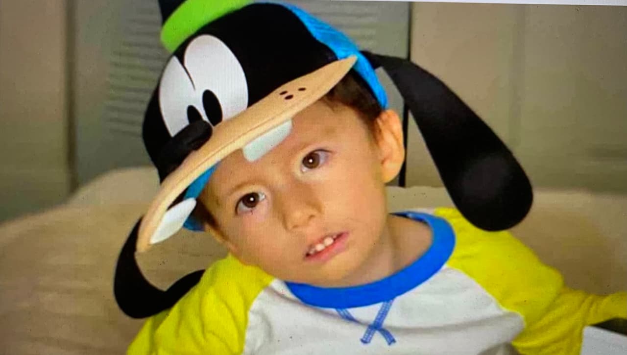 Este pequeño necesita ayuda para sonreír por primera vez. Nació con un síndrome que le paralizó el rostro y debe ser operado