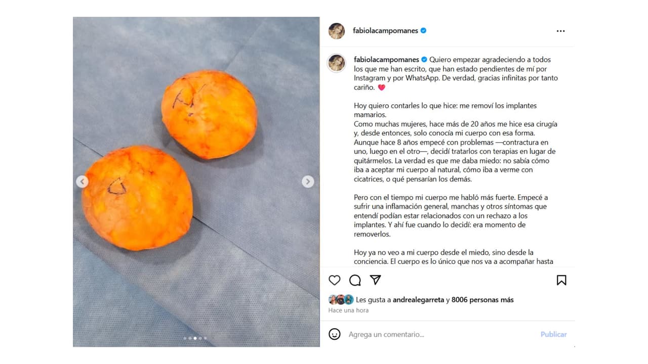La actriz se realizó una extirpación de implantes.
