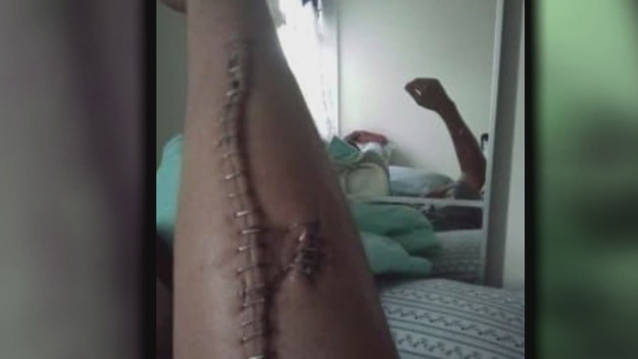 “Sentí odio racial”: hombres mexicanos denuncian violento ataque en Brooklyn