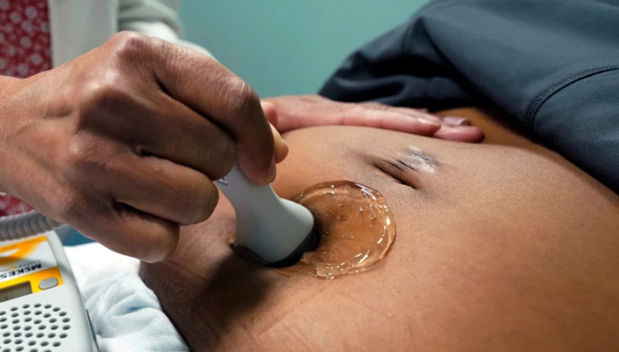 Puerto Rico reconoce al feto como un ser humano: ¿cómo afecta los abortos en la isla?