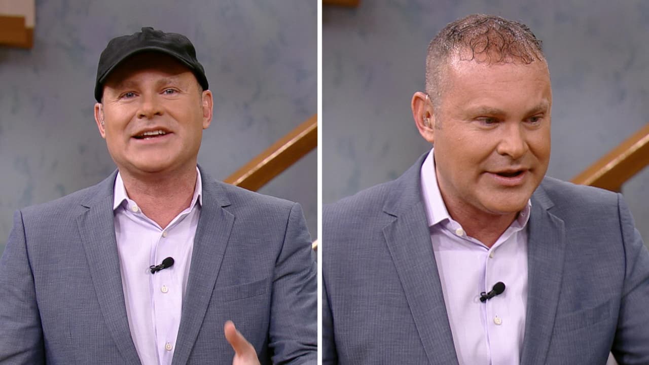 Se quita la gorra, Alan Tacher nuevamente se hizo un trasplante de cabello y así lo mostró