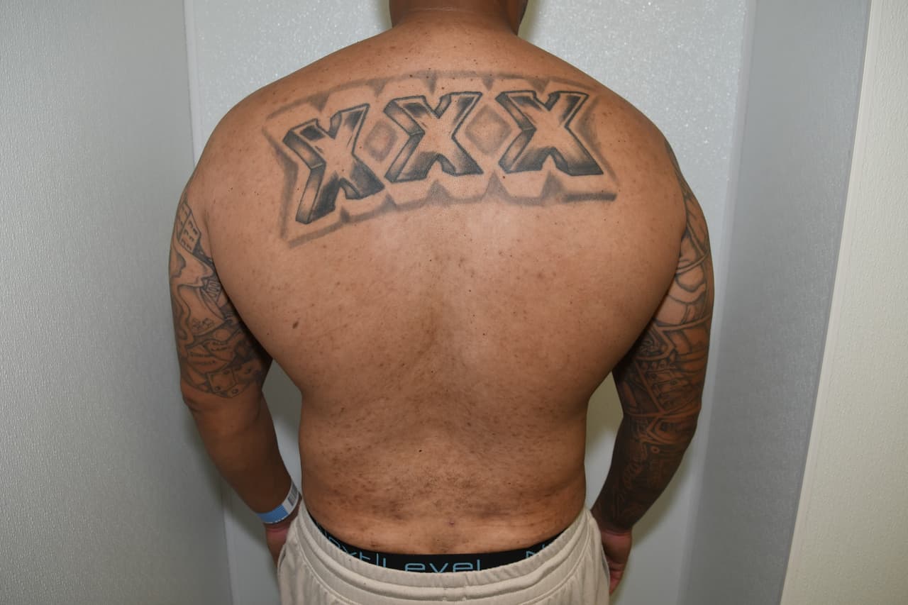 El Narra también tiene un tatuaje con
<b> tres x</b> en la espalda. 
<br>