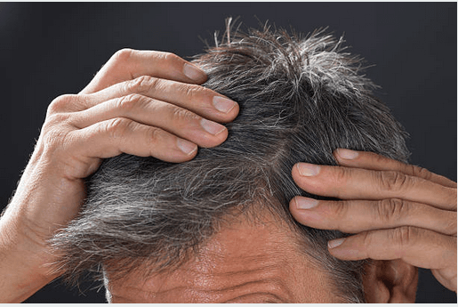 ¿Champú o vinagre? Ni uno ni otro ni la frecuencia de lavado influyen en la calvicie. Esto es lo que dice la ciencia sobre la salud del cabello