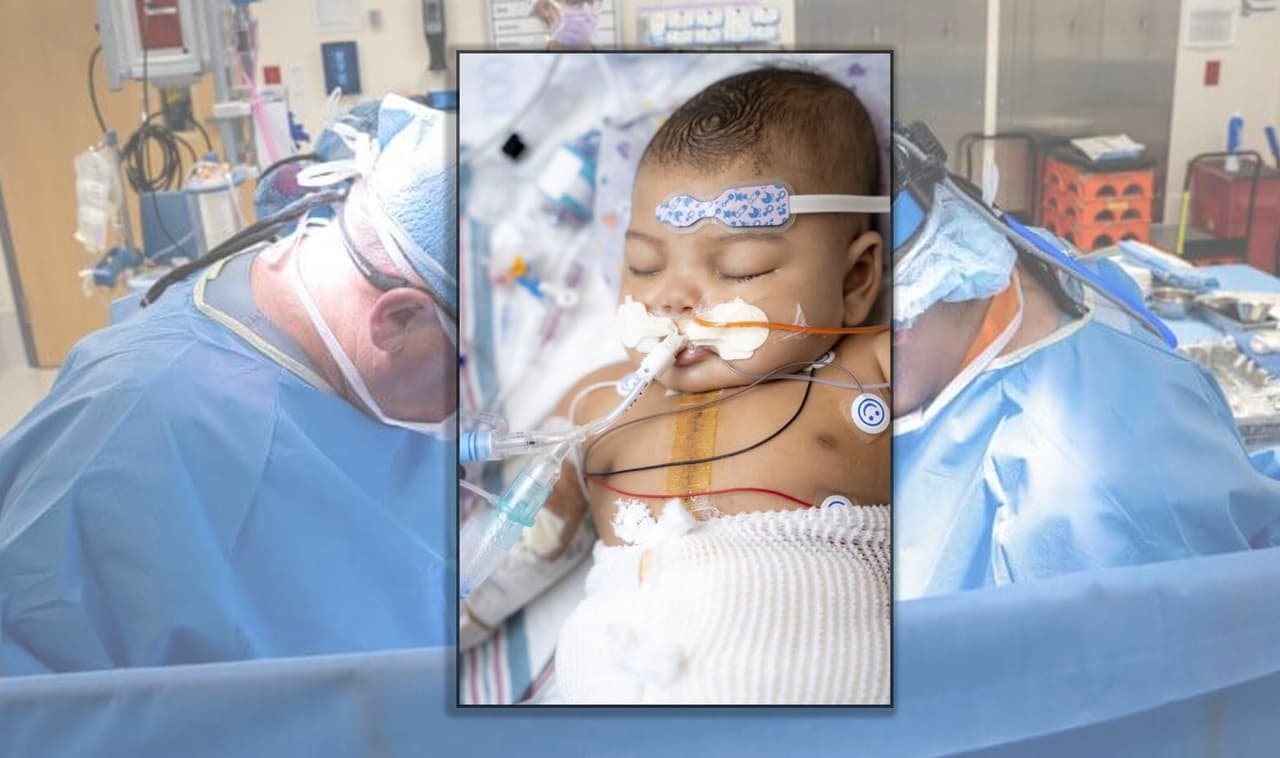 Salvan la vida a una bebé en Texas con un dispositivo especial, mientras espera un trasplante de corazón
