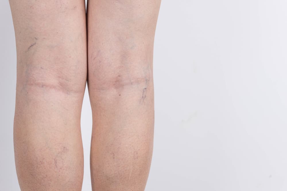 <b>Salud -</b>
<br>La onda vibratoria ambiental te favorecerá mucho particularmente si tus problemas de salud son crónicos y están asociados a las várices, trastornos circulatorios o dificultades cardiacas.