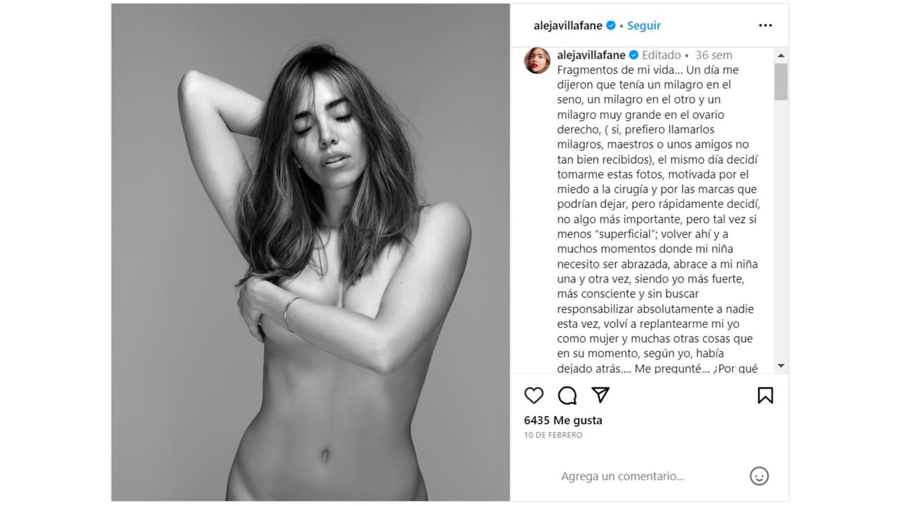Alejandra Villafañe reveló que le encontraron "milagros" en los senos y el ovario derecho.