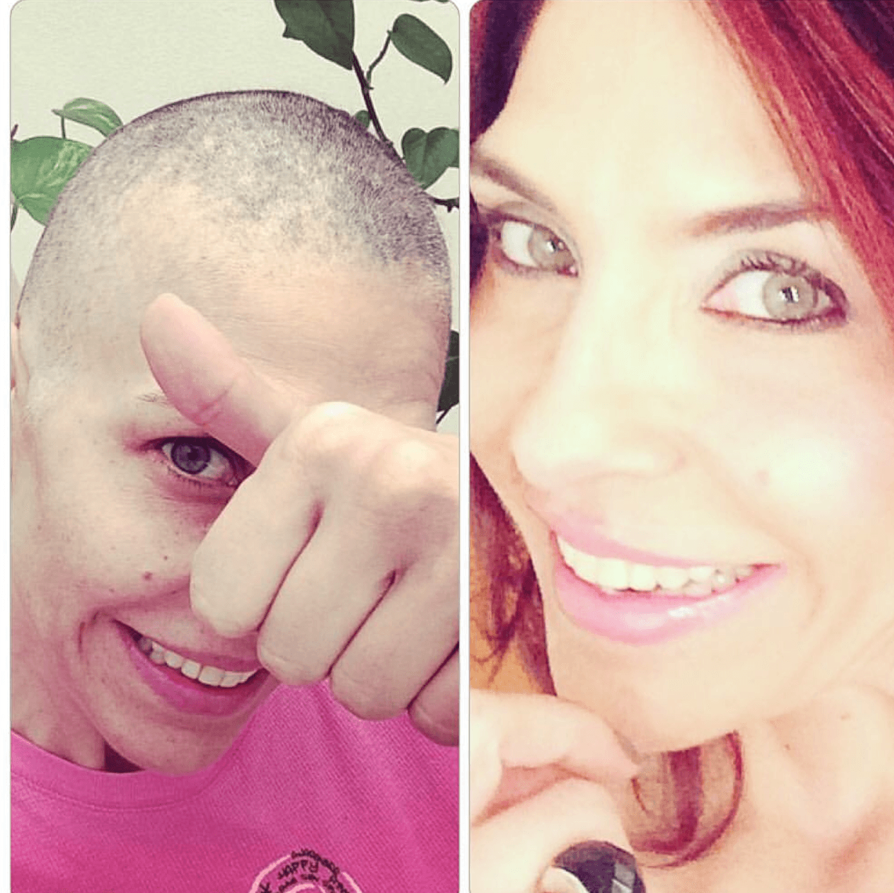 En marzo del 2016 así celebró su lucha contra el cáncer, con este comparativo de su rostro cuando empezó el tratamiento de quimioterapias, con lo que en ese momento era "su nueva vida".