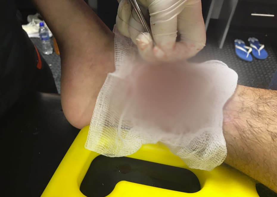 Así quedó el pie de Hirving Lozano tras una terrible falta de Michael Orozco