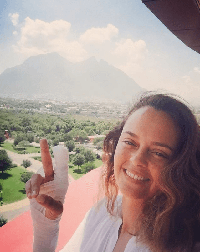 "Bien, haciendo rehabilitación e intentando cerrar el puño, casi lo logro, pero poco a poco", explicó sin querer dar detalles del accidente.
<br>