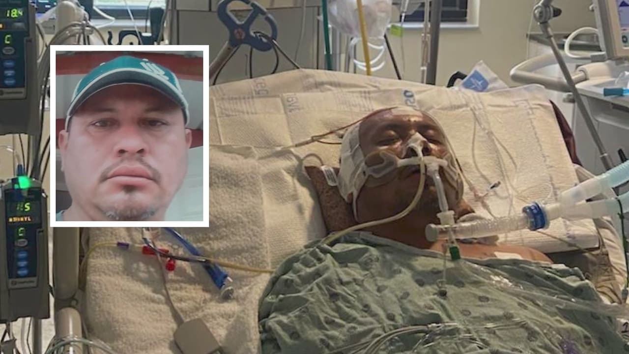 El hombre, de 42 años, que fue identificado como 
<b><a href="https://www.univision.com/local/houston-kxln/familia-david-gonzalez-denuncia-trato-injusto-hospital-hca-healthcare-texas" target="_blank">David González,</a></b> recibió un fuerte golpe en la cabeza durante un ataque afuera de una tienda.
