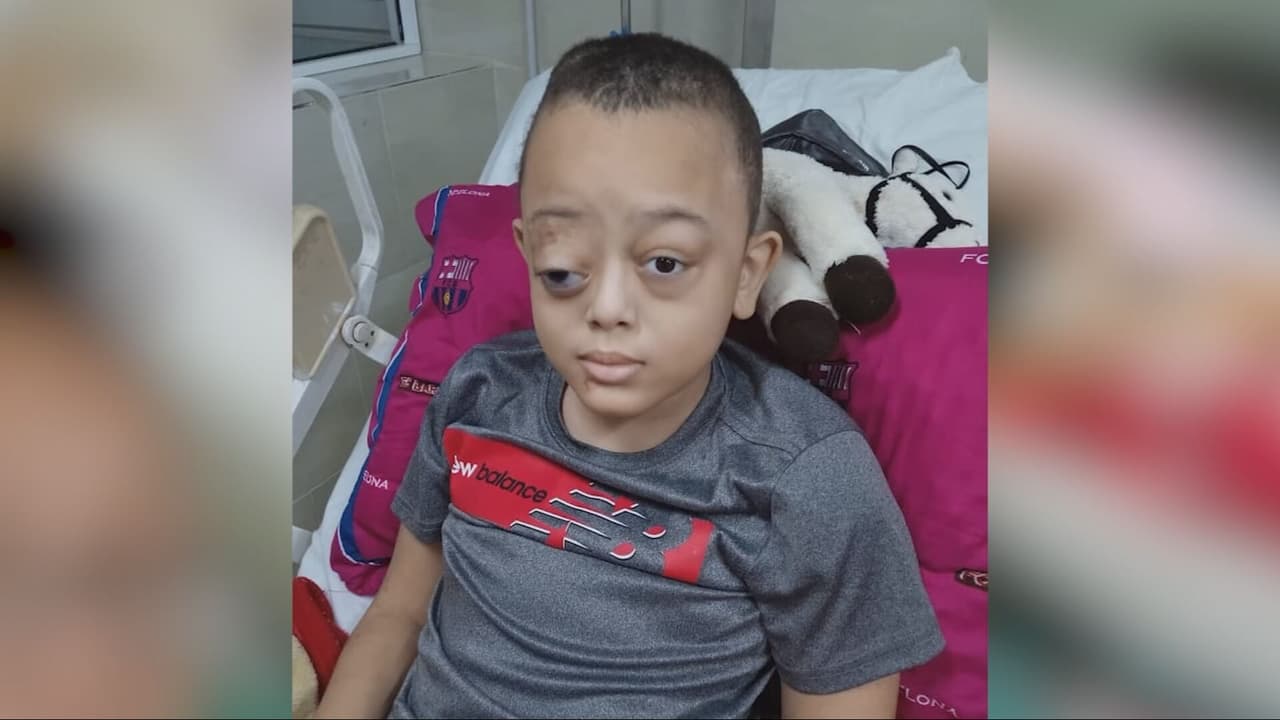 Solo falta un documento para que niño cubano con grave enfermedad pueda viajar a EEUU a recibir tratamiento