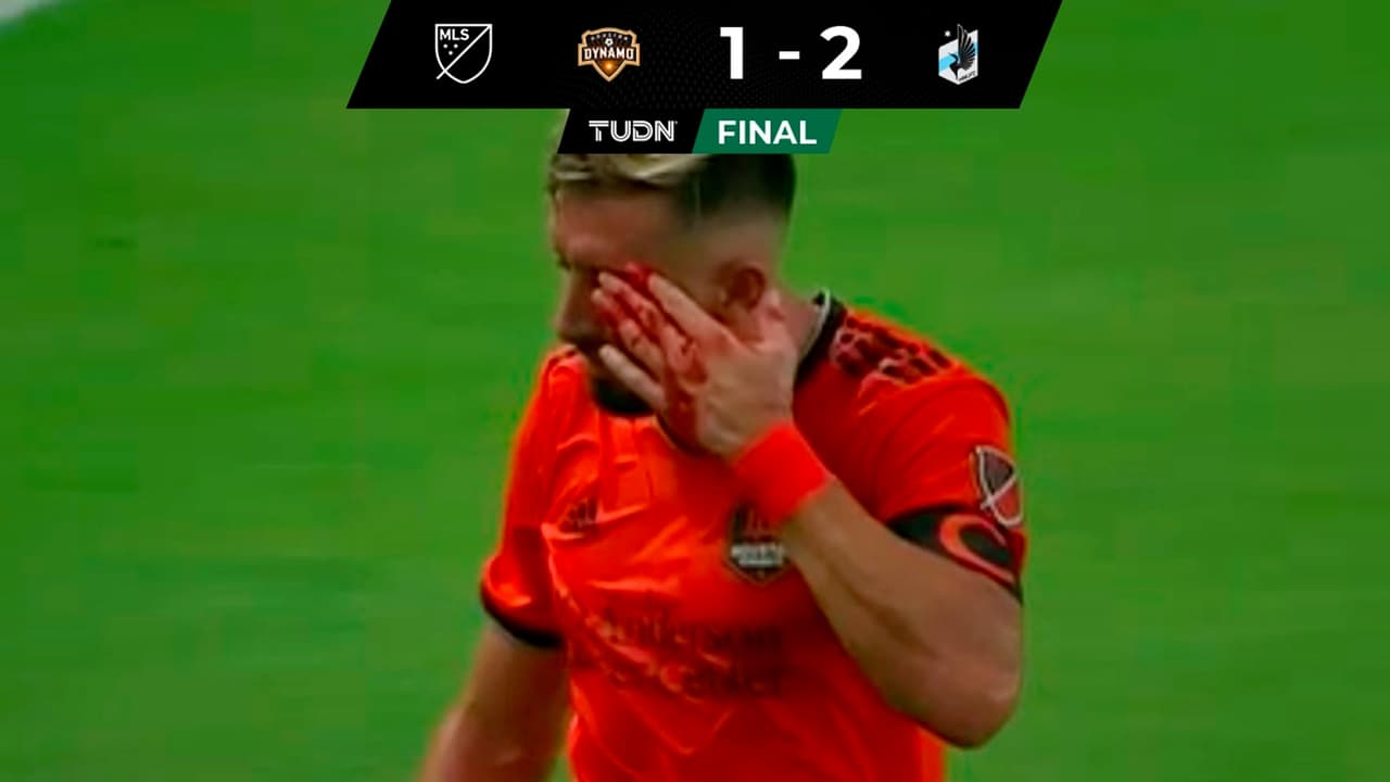 Herrera sufre hemorragia tras duro golpe en derrota del Dynamo