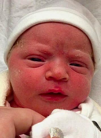 El cáncer fue detectado a tiempo, de modo que puede ser tratado.