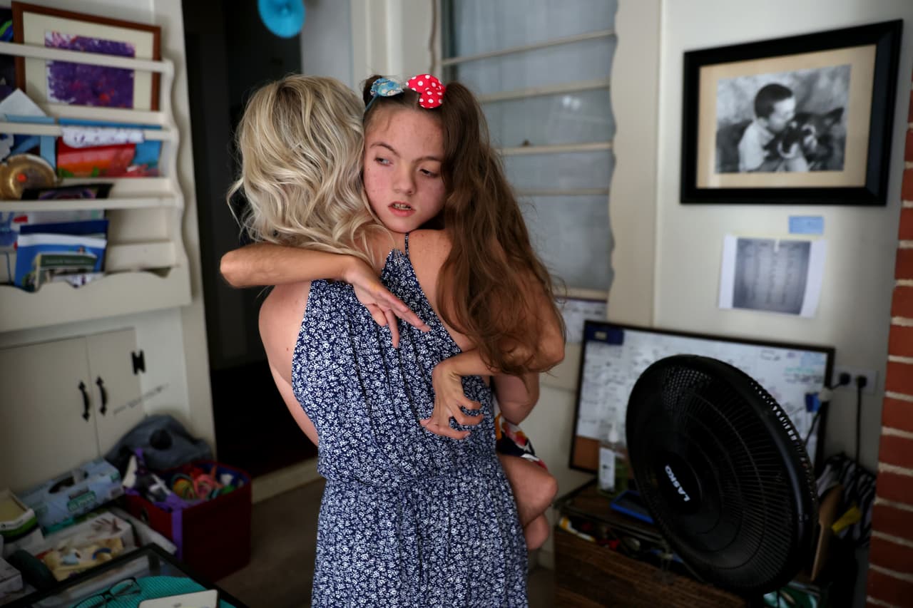 Este síndrome provoca atrofia muscular en las extremidades, epilepsia, problemas de sueño y de visión.
<br>