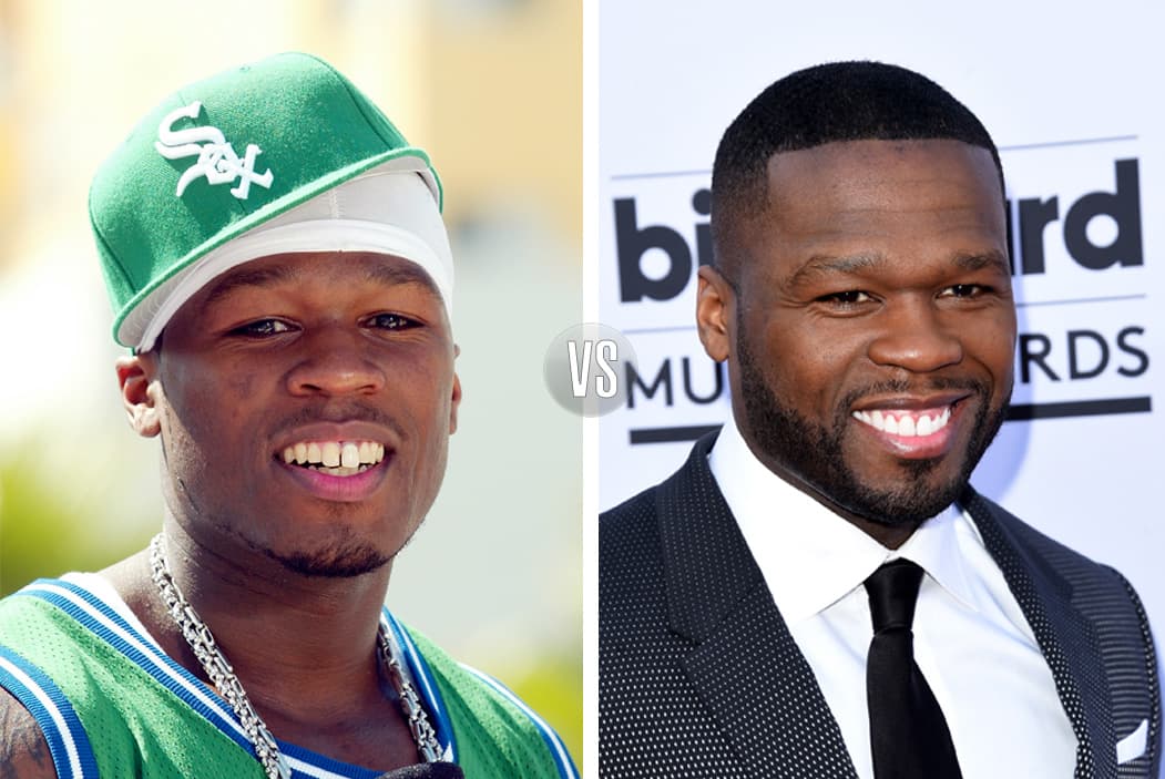 A 50 Cent también le ha ganado la vanidad, por eso se arregló los dientes y vaya que mejoró demasiado.