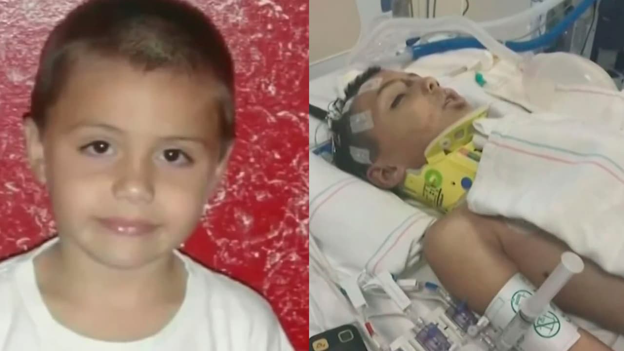 De acuerdo con el documento de la demanda a Anthony le pegaron con un cinturón, lo azotaron contra la pared, le echaron salsa picante en la cara, lo colgaron boca abajo, lo dejaron caer de cabeza, abusaron sexualmente y hasta lo obligaron a arrodillarse sobre arroz.
<br>
<br>Los castigos más crueles propinados por la pareja al menor sucedieron durante los cinco días previos a su muerte, hasta que el 16 de junio de 2018 su madre llamó al 911 ante la condición crítica del menor.