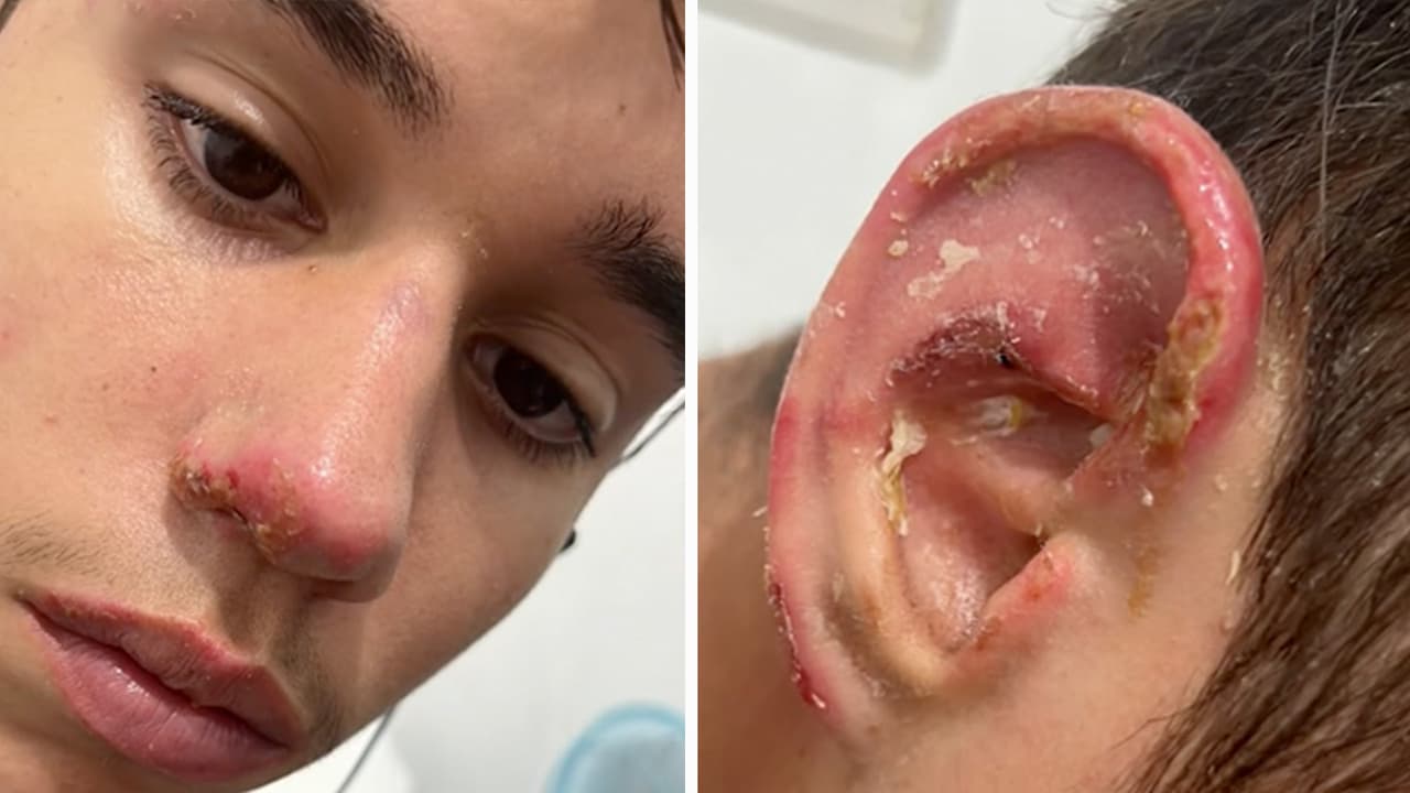 El menor de 16 años por ahora se encuentra en un sitio en México que la familia prefirió no revelar por seguridad. Ellos temen que al no tener ninguna documentación, debido a que todo se quemó en el accidente, el adolescente pueda ser deportado.