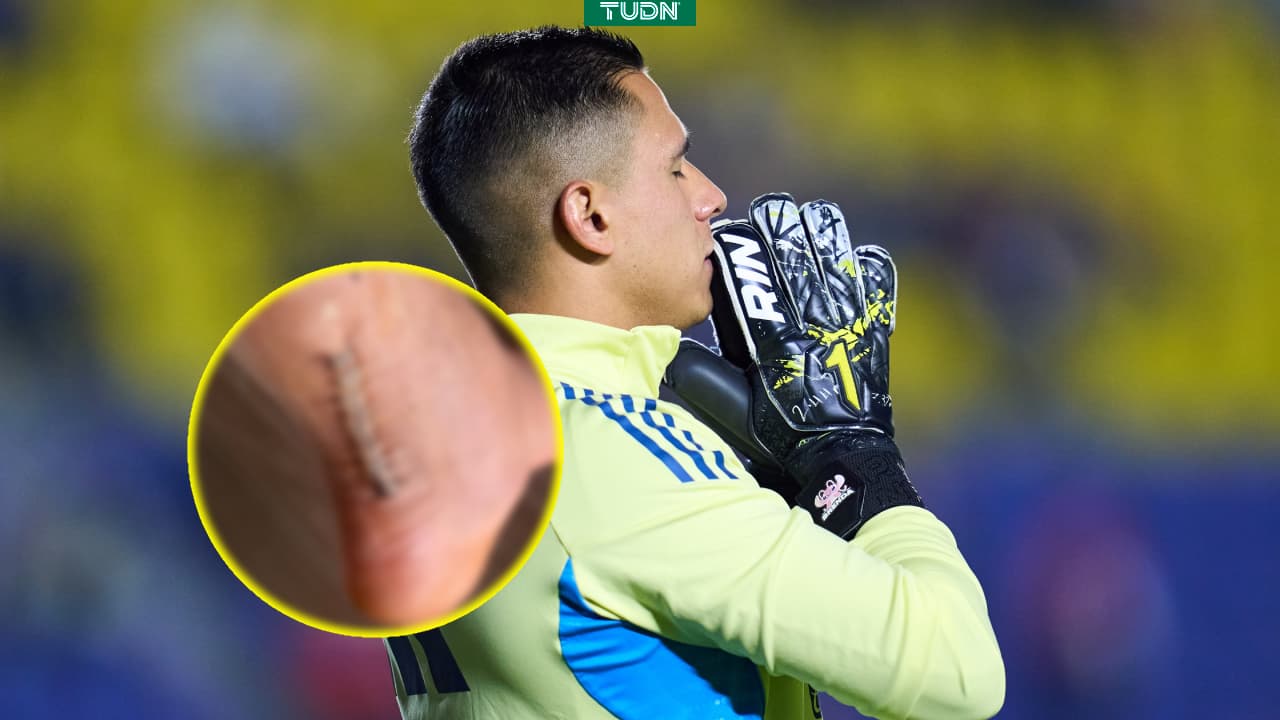 Luis Malagón muestra la grave herida que lo dejó sin Mundial 2026