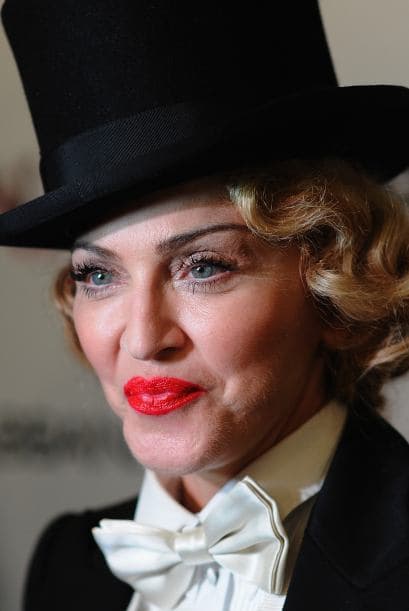 Pero los años y excesos la arrugaron un "poquito". La cantante no encontró más remedio que ponerse botox.