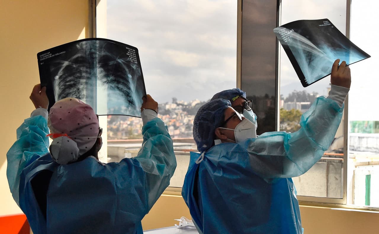 Aunque el covid-19 ya ha cumplido dos años, sigue siendo un virus nuevo que requerirá de 
<a href="https://www.univision.com/local/los-angeles-kmex/50-secuelas-coronavirus-covid-19-largo-plazo-comunes">cientos de estudios científicos</a> para abordar los efectos que este ha causado en millones de personas que se han contagiado.