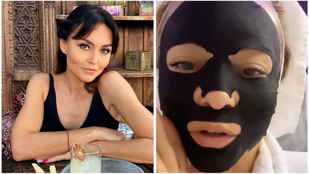 Angelique Boyer se arruinó el rostro por seguir un tratamiento que leyó en internet: "No improvisen"