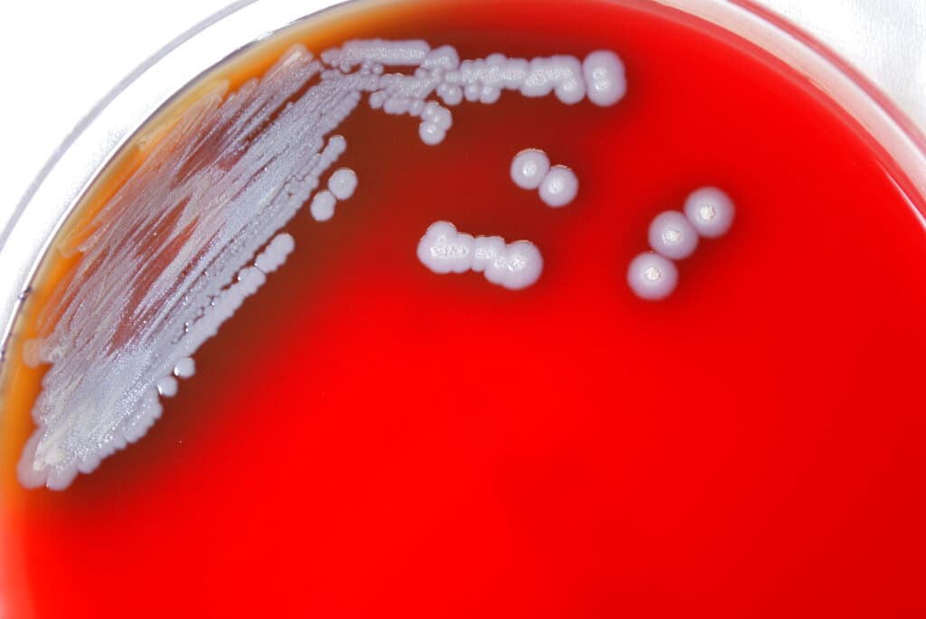 Una bacteria que causa una rara enfermedad es encontrada por primera vez en EEUU: estos son los síntomas y riesgos