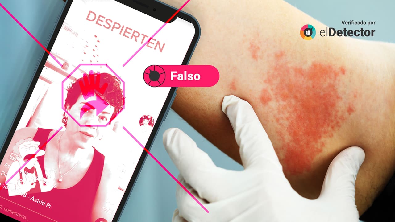 El herpes zóster no es un efecto secundario de la vacuna contra el covid-19: verificamos video de TikTok 