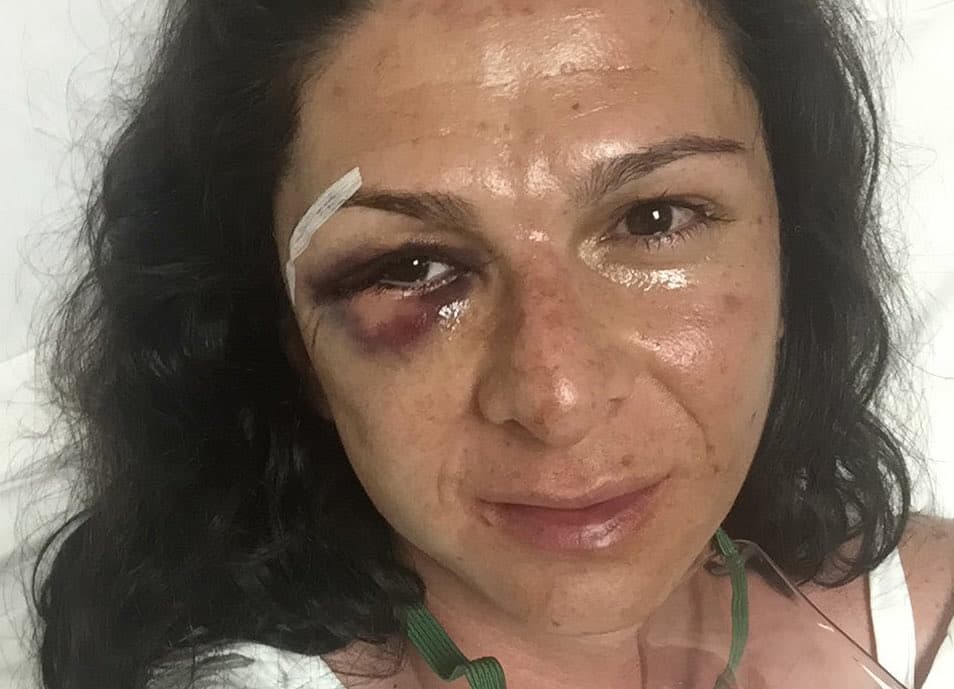 Golpes en la cara de la senadora mexicana Ana Gabriel Guevara