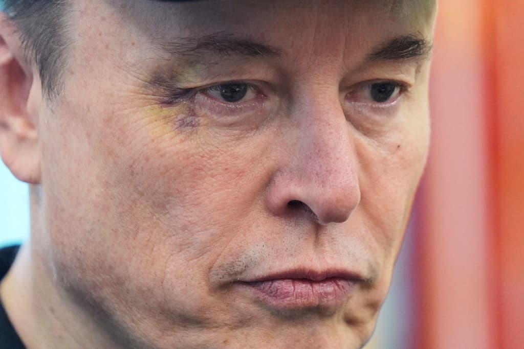 El ojo morado de Elon Musk durante una conferencia de prensa con el presidente Donald Trump en la Oficina Oval de la Casa Blanca, el viernes 30 de mayo de 2025, en Washington.