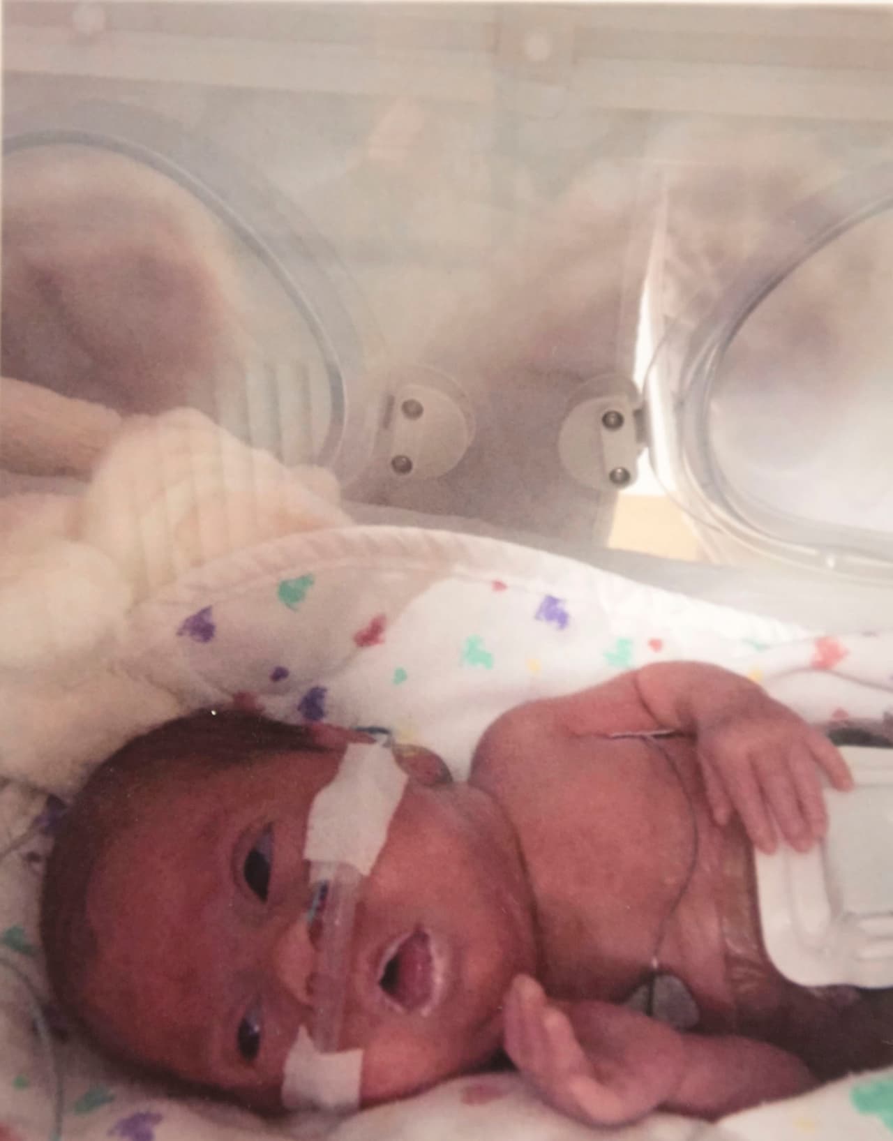 Durante la semana 30, aún 10 semanas siendo prematura, fue transferida al hospital St. George de Londres.