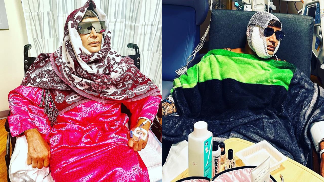 Eduardo Antonio apareció con el look de la izquierda a solo horas antes de que sea dado de alta. El 'outfit' ha dividido opiniones entre sus seguidores.