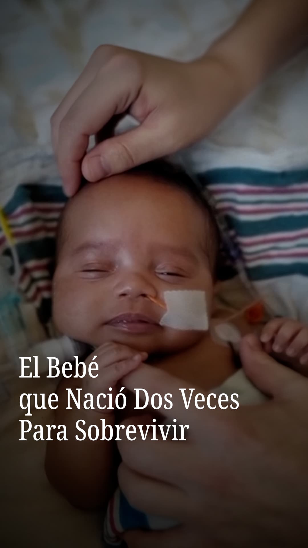 El bebé que nació dos veces para sobrevivir