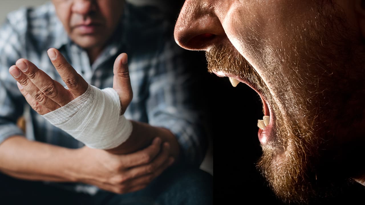 Sujeto se mete a una casa y ataca a mordidas a sus residentes, en San Francisco