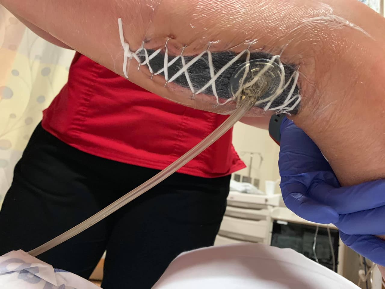 El lugar en donde Kylei Brown contrajo la bacteria fue en Destin, una playa en el condado Okaloosa ubicado en la costa este de Florida.