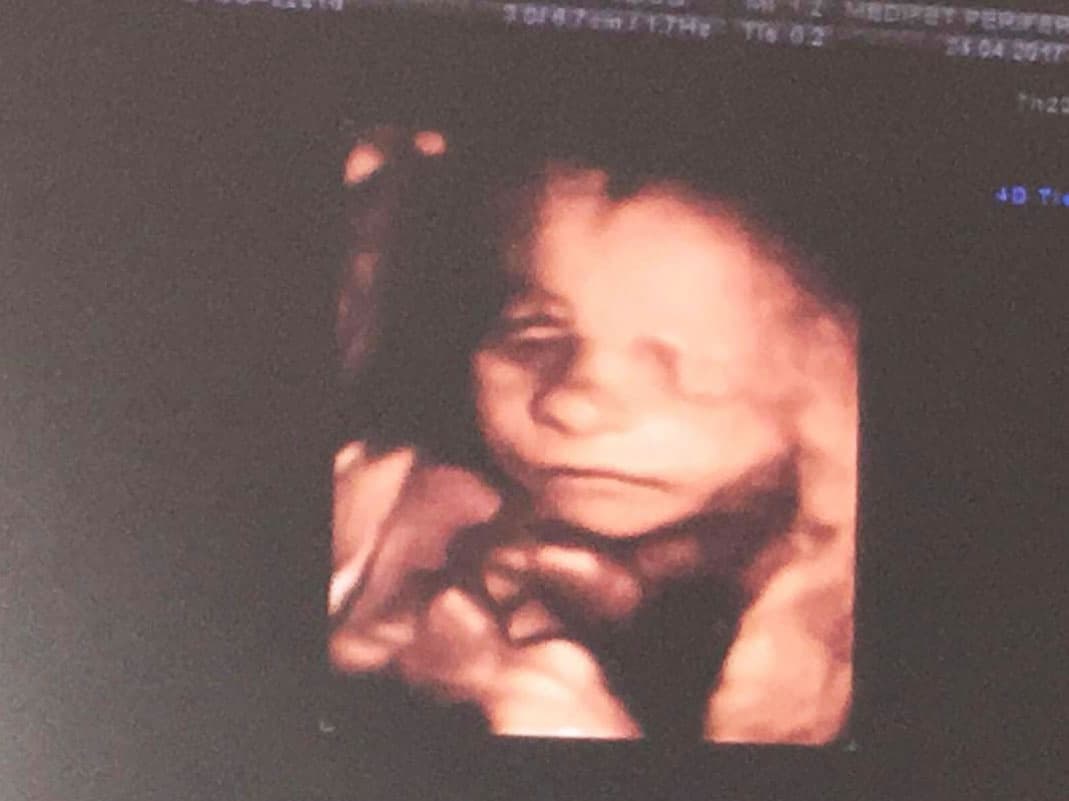 <a href="http://www.univision.com/novelas/vino-el-amor/la-actriz-mar-contreras-anuncia-su-segundo-embarazo-con-tierna-fotografia">Tendrá otro niño y su nombre será Mariano</a>, por lo que en cualquier momento nos sorprenderá con la noticia del nacimiento del pequeño.