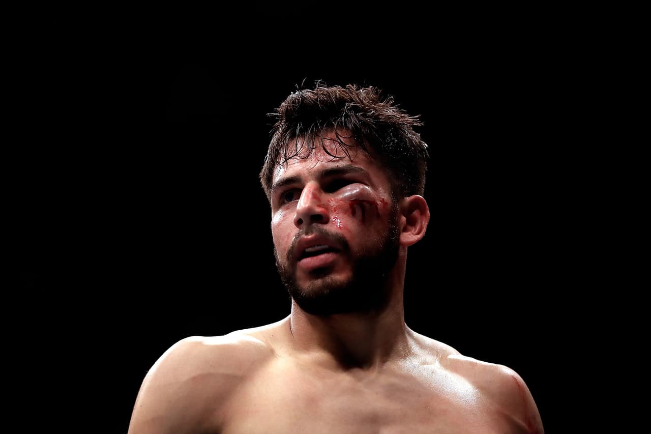 DALLAS, TX - MAY 13: Yair Rodriguez suffers a cut under the eye during his Featherweight bout against Frankie Edgar during UFC 211 at American Airlines Center on May 13, 2017 in Dallas, Texas. (Photo by Ronald Martinez/Getty Images)