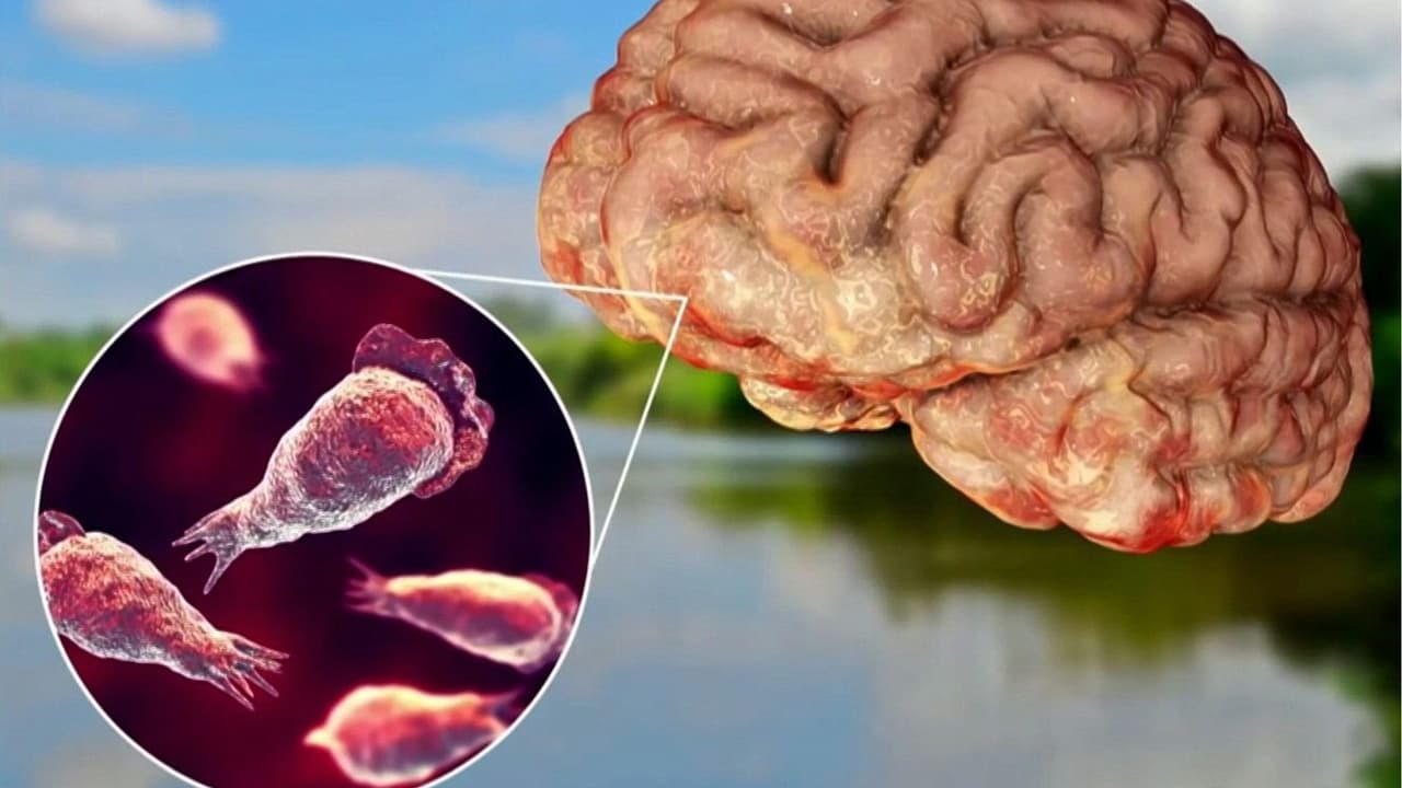 ¿Cómo entra al cuerpo la 'ameba comecerebros'? Infectólogo explica los riesgos y síntomas