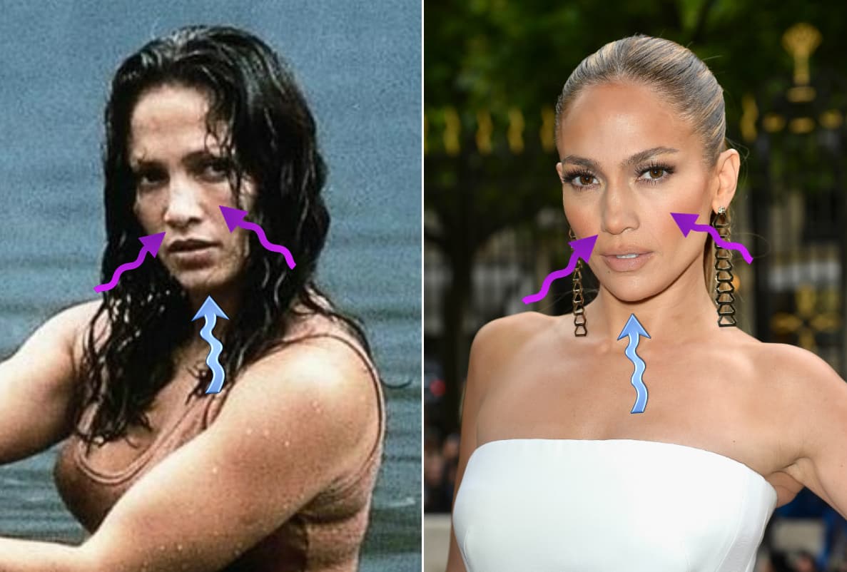 'Jen' le apostó a una barbilla refinada, unos cachetitos menos regordetes y una nariz puntiaguda y estilizada.