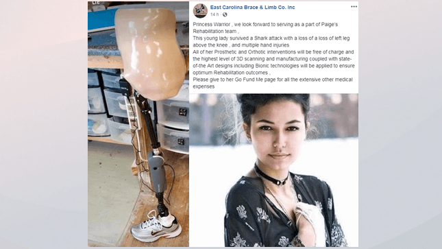 La joven mordida por tiburón recibirá prótesis gratuita 