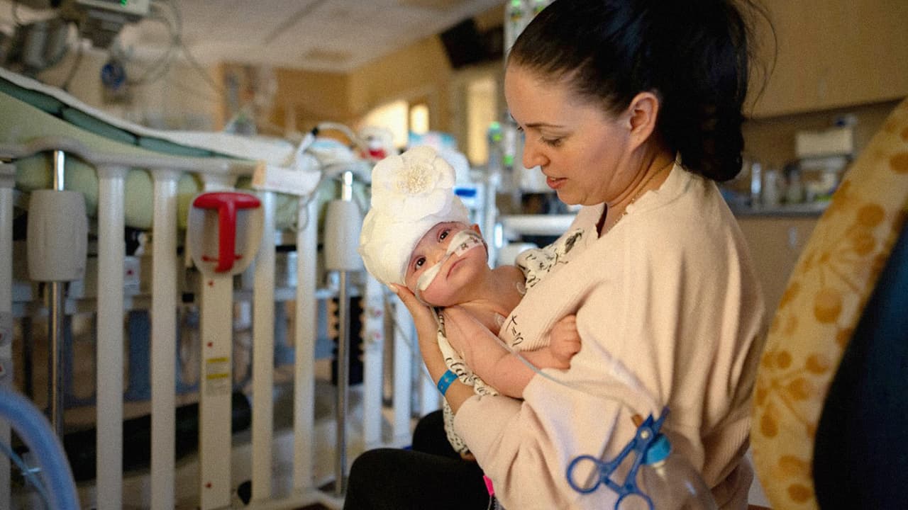 Liliya Miroshnik y su hija Micaela de 9 meses, luego de una cirugía donde la pequeña fue separada de su hermana, con la que había nacido unida por la cabeza.