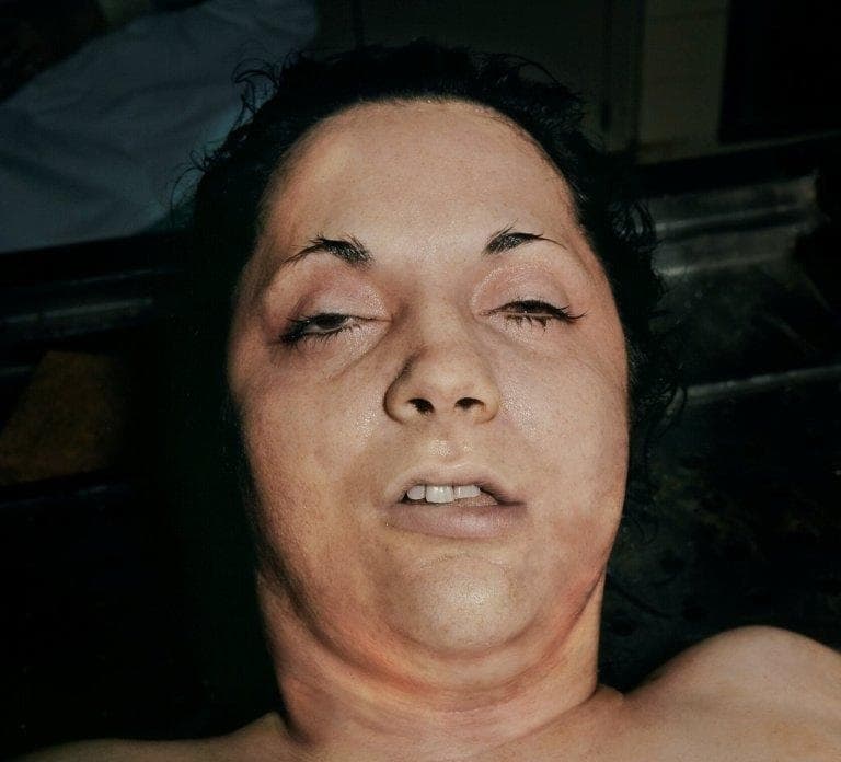 La Policía describe a la mujer como una veinteañera de complexión robusta, de 5 pies y 3 pulgadas de altura, cabello oscuro que cae hasta sus mejillas, cejas delgadas y ojos oscuros.