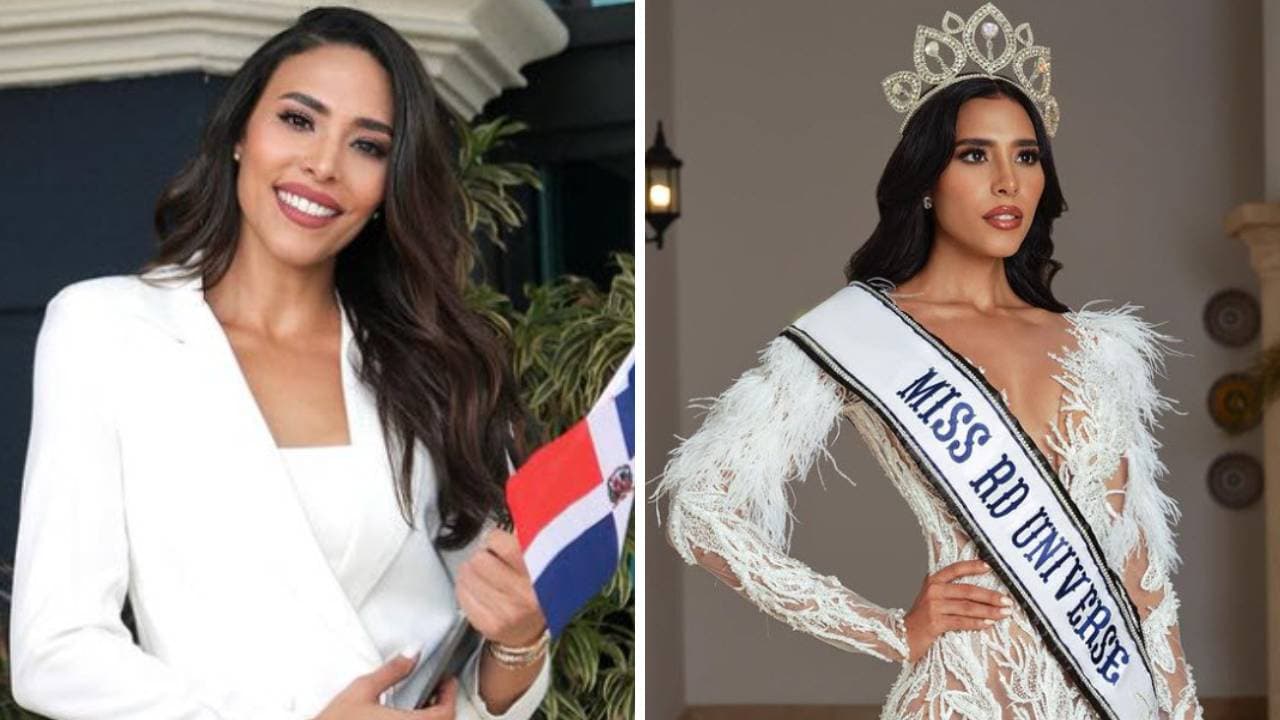 Exreina de belleza sufre quemaduras en cuerpo y rostro tras explosión de olla: este es su estado de salud