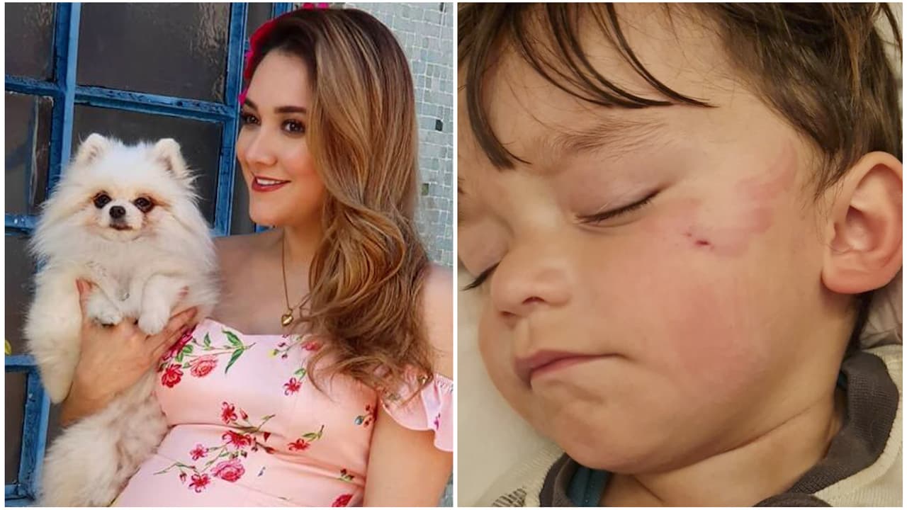 Sherlyn aclara si se deshizo de su perrita ‘La Neni’ tras haber mordido a su hijo André en la cara