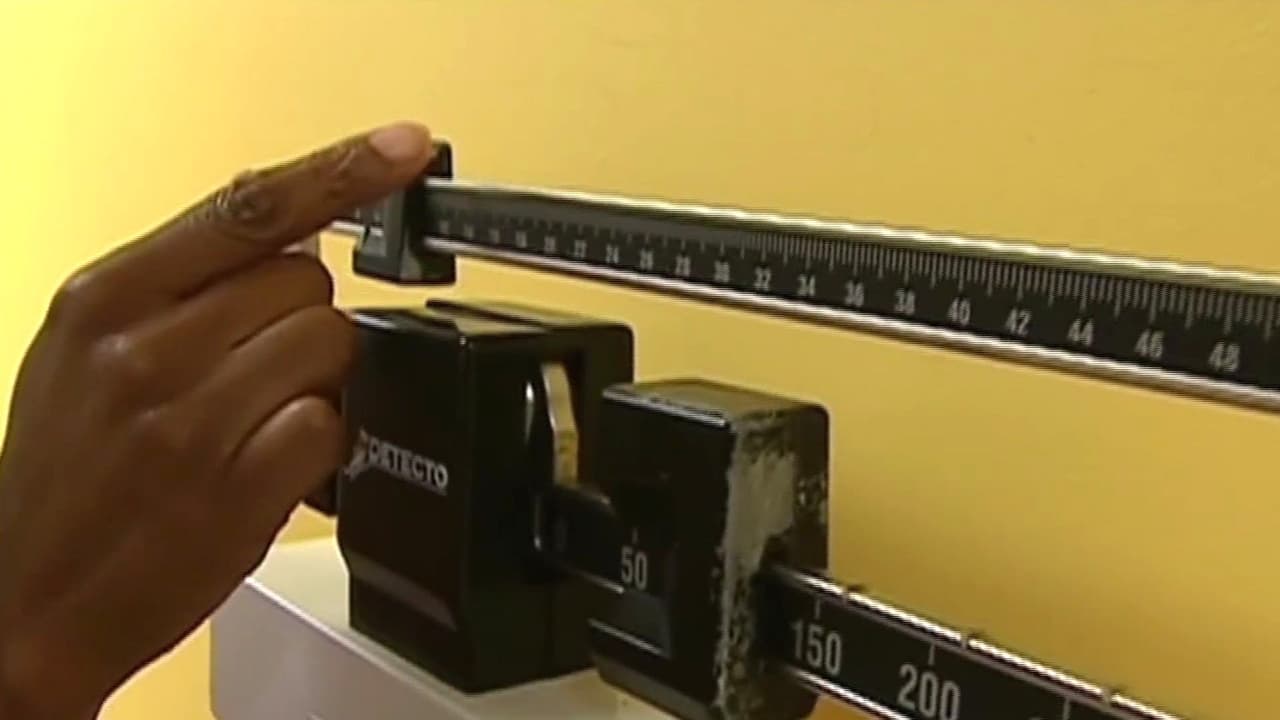 ¿Es riesgoso el uso de fármacos GLP-1 contra la obesidad infantil?