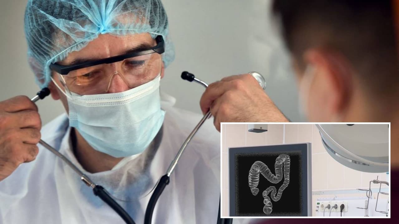 Diarrea, estreñimiento, dolor abdominal y otros síntomas para identificar el cáncer de colon