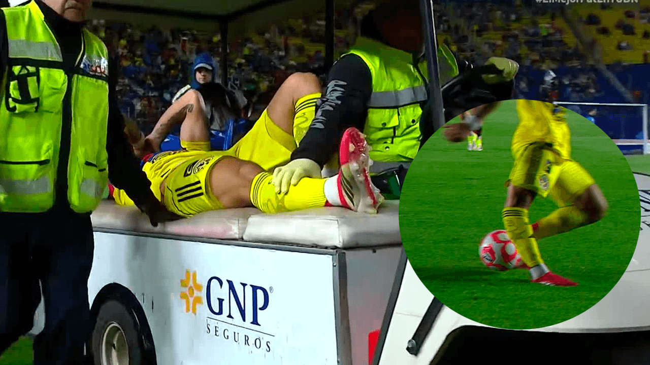 Víctor Dávila sufre lesión de rodilla en el América vs. Juárez