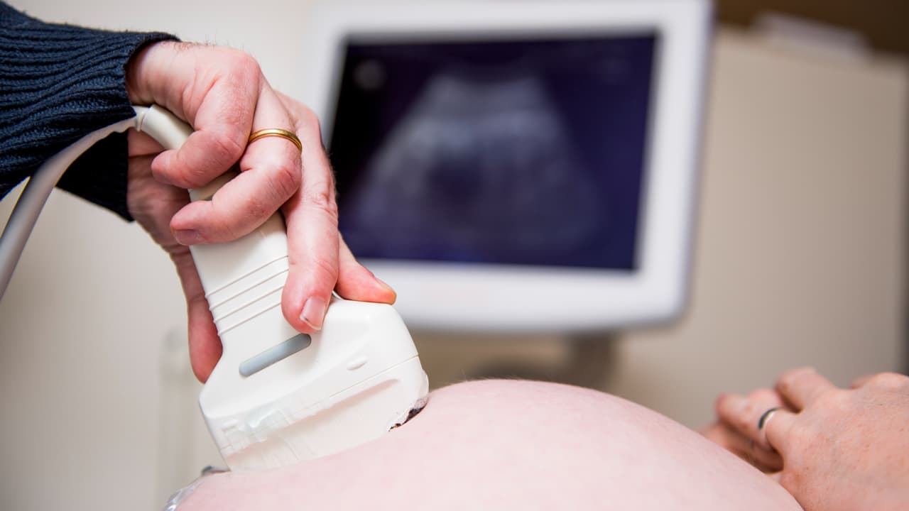 Corte Suprema de Florida analiza enmienda sobre el aborto