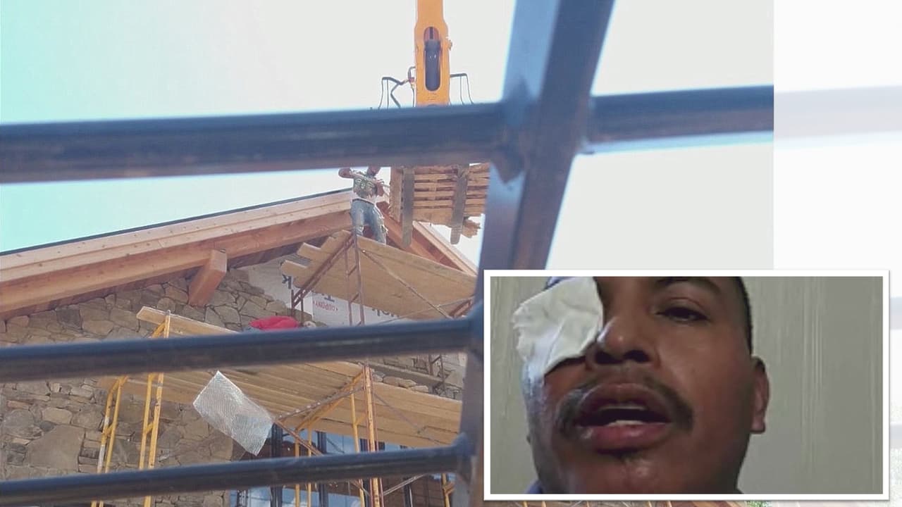 “Me cayó un pedazo de concreto en el ojo”: hispano denuncia el accidente que puso en riesgo su futuro laboral 